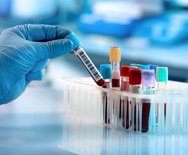5 Reasons to Book Lab Collection at Home in Dubai with Neo Home Healthcare